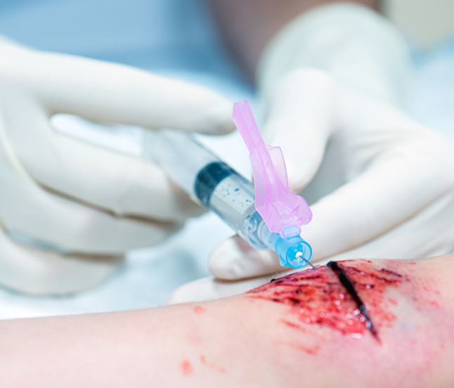 Procedures